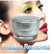 New Arrival Fancy Acne and Freckle Cream at Wholesale Price